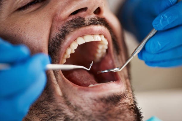 Best Emergency Denture Repair in Danville, CA