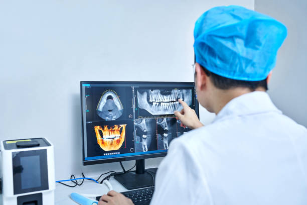 Best Emergency Root Canal Therapy in Danville, CA
